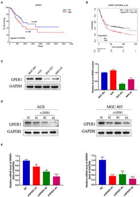 GPER1 Silencing Suppresses the Proliferation, Migration, and Invasion of Gastric Cancer Cells by Inhibiting PI3K/AKT–Mediated EMT